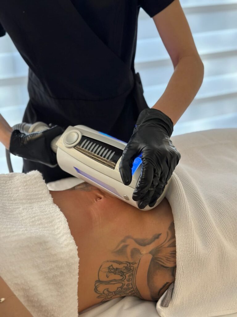 Endospheres Therapy is designed to enhance your beauty and well-being by stimulating circulation, toning the skin, and reducing cellulite. Our skilled professionals have undergone extensive training to provide you with the highest level of care, ensuring you achieve visible and lasting results.